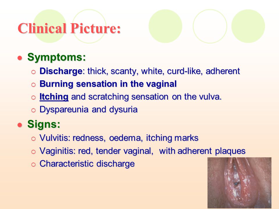 Pregnant and vaginal itching